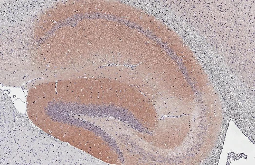 Muscarinic Acetylcholine Receptor M1/CHRM1 antibody [HL3933] detects Muscarinic Acetylcholine Receptor M1/CHRM1 protein by immunohistochemical analysis.Sample: Paraffin-embedded mouse hippocampus.Muscarinic Acetylcholine Receptor M1/CHRM1 stained by Muscarinic Acetylcholine Receptor M1/CHRM1 antibody [HL3933] (NBP3-48854) diluted at 1:2000.Antigen Retrieval: Tris-EDTA buffer, pH 9.0, 15 min 