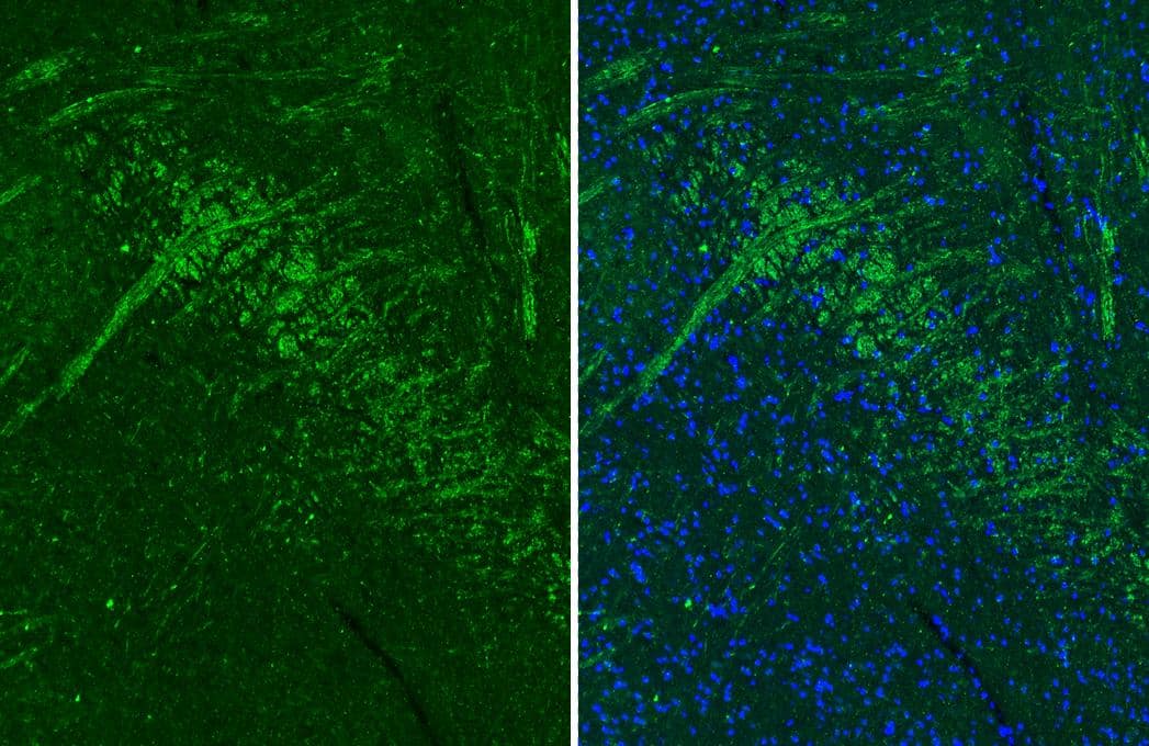 <b>Orthogonal Strategies Validation. </b>Muscarinic Acetylcholine Receptor M1/CHRM1 antibody [HL3933] detects Muscarinic Acetylcholine Receptor M1/CHRM1 protein by immunohistochemical analysis.Sample: Paraffin-embedded mouse striatum.Green: Muscarinic Acetylcholine Receptor M1/CHRM1 stained by Muscarinic Acetylcholine Receptor M1/CHRM1 antibody [HL3933] (NBP3-48854) diluted at 1:250.Red: beta Tubulin 3/ Tuj1 antibody [GT11710] diluted at 1:500.Blue: Hoechst 33342 staining.Antigen Retrieval: Tris-EDTA buffer, pH 9.0, 15 min 