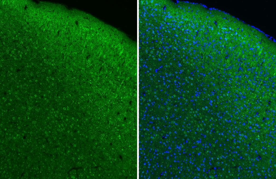 Muscarinic Acetylcholine Receptor M1/CHRM1 antibody [HL3933] detects Muscarinic Acetylcholine Receptor M1/CHRM1 protein by immunohistochemical analysis.Sample: Paraffin-embedded mouse cerebral cortex.Green: Muscarinic Acetylcholine Receptor M1/CHRM1 stained by Muscarinic Acetylcholine Receptor M1/CHRM1 antibody [HL3933] (NBP3-48854) diluted at 1:250.Red: beta Tubulin 3/ Tuj1 antibody [GT11710] diluted at 1:500.Blue: Hoechst 33342 staining.Antigen Retrieval: Tris-EDTA buffer, pH 9.0, 15 min 