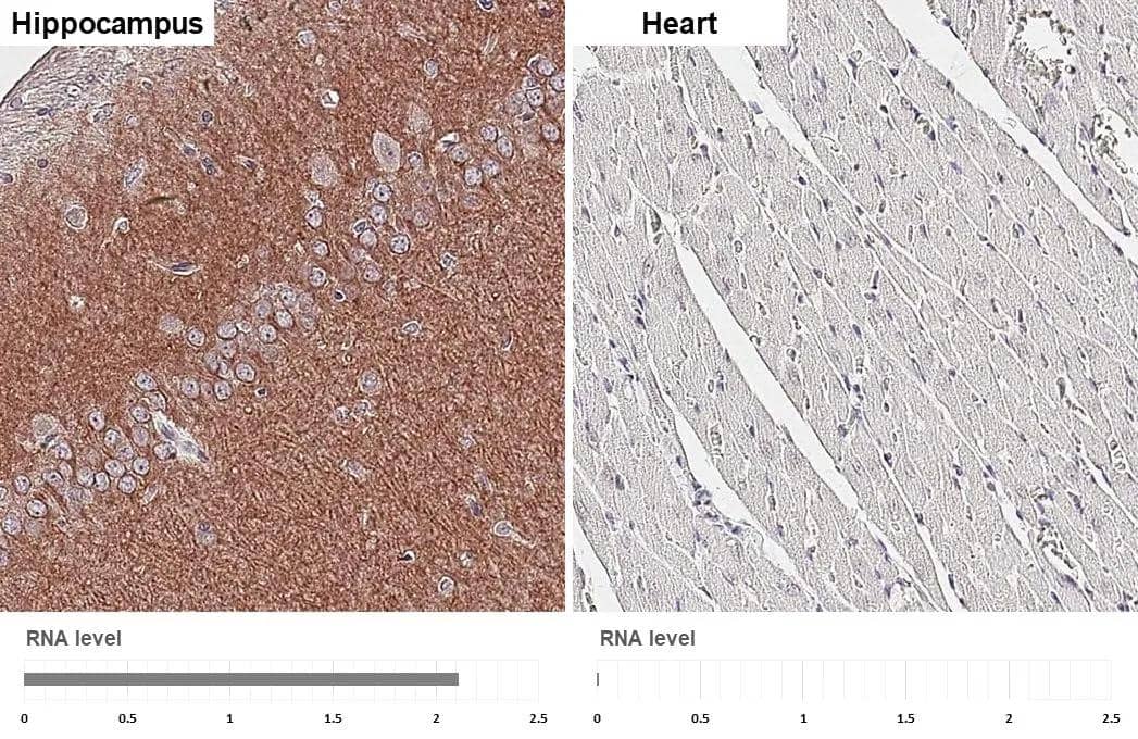 Muscarinic Acetylcholine Receptor M1/CHRM1 antibody [HL3933] detects Muscarinic Acetylcholine Receptor M1/CHRM1 protein by immunohistochemical analysis.Sample: Paraffin-embedded rat tissues.Muscarinic Acetylcholine Receptor M1/CHRM1 stained by Muscarinic Acetylcholine Receptor M1/CHRM1 antibody [HL3933] (NBP3-48854) diluted at 1:200.Antigen Retrieval: Tris-EDTA buffer, pH 9.0, 15 min 