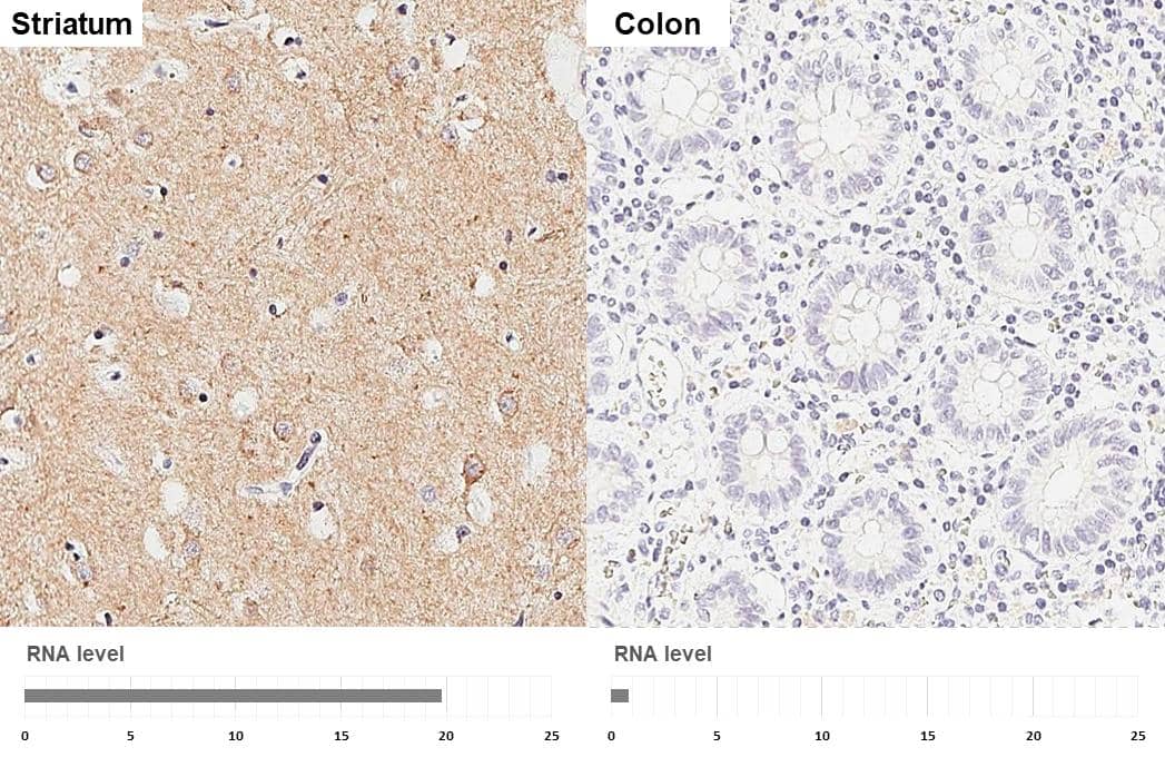 <b>Orthogonal Strategies Validation. </b>Muscarinic Acetylcholine Receptor M1/CHRM1 antibody [HL3933] detects Muscarinic Acetylcholine Receptor M1/CHRM1 protein by immunohistochemical analysis.Sample: Paraffin-embedded human tissues.Muscarinic Acetylcholine Receptor M1/CHRM1 stained by Muscarinic Acetylcholine Receptor M1/CHRM1 antibody [HL3933] (NBP3-48854) diluted at 1:200.Antigen Retrieval: Tris-EDTA buffer, pH 9.0, 15 min 