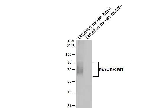 <b>Orthogonal Strategies Validation. </b>Unboiled various tissue extracts (50 ug) were separated by 10% SDS-PAGE, and the membrane was blotted with Muscarinic Acetylcholine Receptor M1/CHRM1 antibody [HL3933] (NBP3-48854) diluted at 1:1000. The HRP-conjugated anti-rabbit IgG antibody was used to detect the primary antibody. 