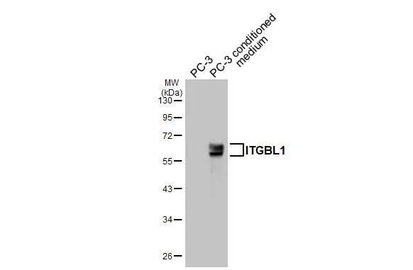 PC-3 whole cell extract and conditioned medium (30 ug) were separated by 10% SDS-PAGE, and the membrane was blotted with Integrin beta-like protein 1 antibody [HL3944] (NBP3-48855) diluted at 1:1000. The HRP-conjugated anti-rabbit IgG antibody was used to detect the primary antibody. 