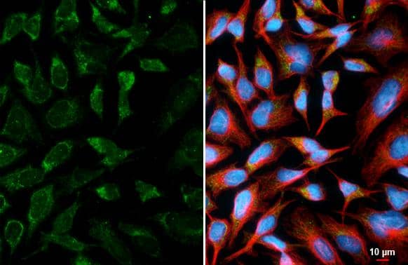 ATPG antibody [HL3949] detects ATPG protein by immunofluorescent analysis.Sample: HeLa cells were fixed in ice-cold MeOH for 5 min.Green: ATPG stained by ATPG antibody [HL3949] (NBP3-48856) diluted at 1:500.Red: alpha Tubulin, a cytoskeleton marker, stained by alpha Tubulin antibody [GT114] diluted at 1:1000.Blue: Fluoroshield with DAPI . 