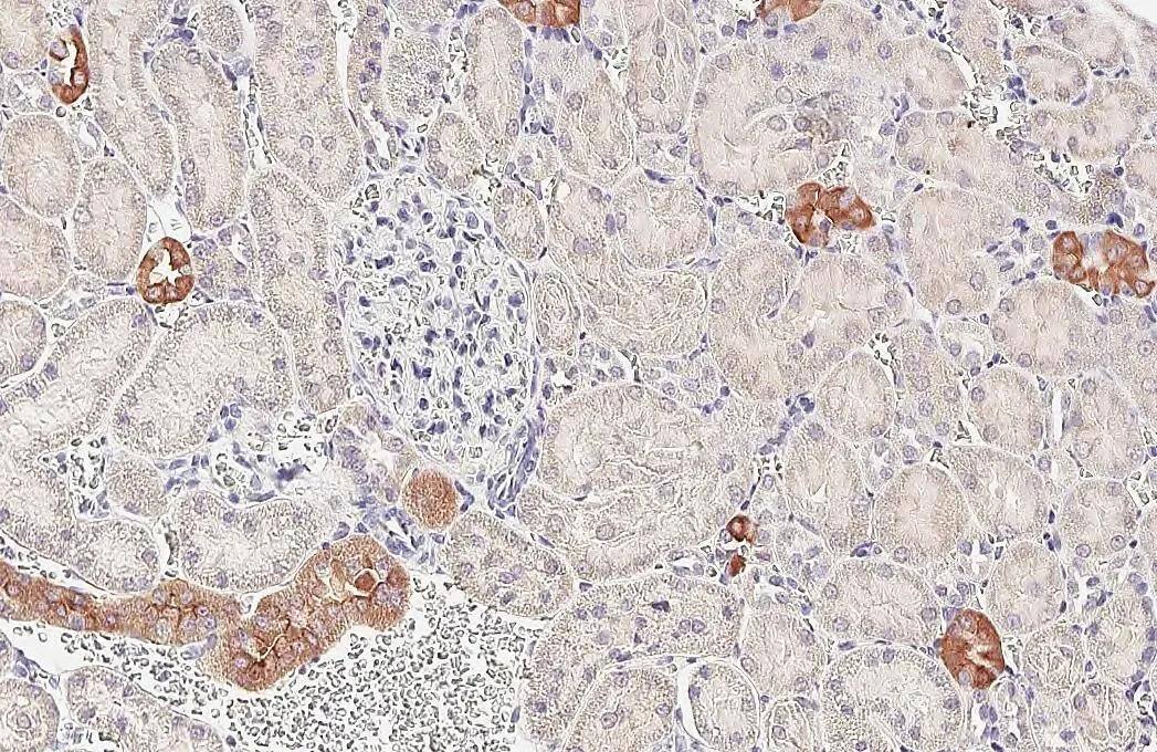 PHACTR1 antibody [HL3954] detects PHACTR1 protein by immunohistochemical analysis.Sample: Paraffin-embedded rat kidney.PHACTR1 stained by PHACTR1 antibody [HL3954] (NBP3-48857) diluted at 1:200.Antigen Retrieval: Tris-EDTA buffer, pH 9.0, 15 min 
