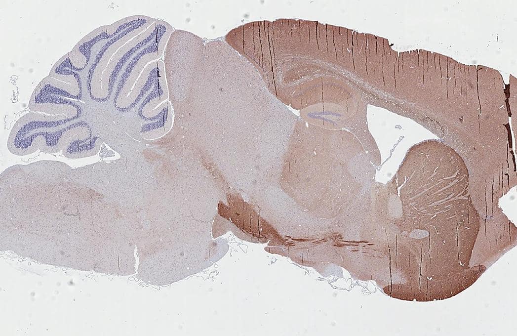 Immunohistochemistry-Paraffin PHACTR1 Antibody (HL3954)