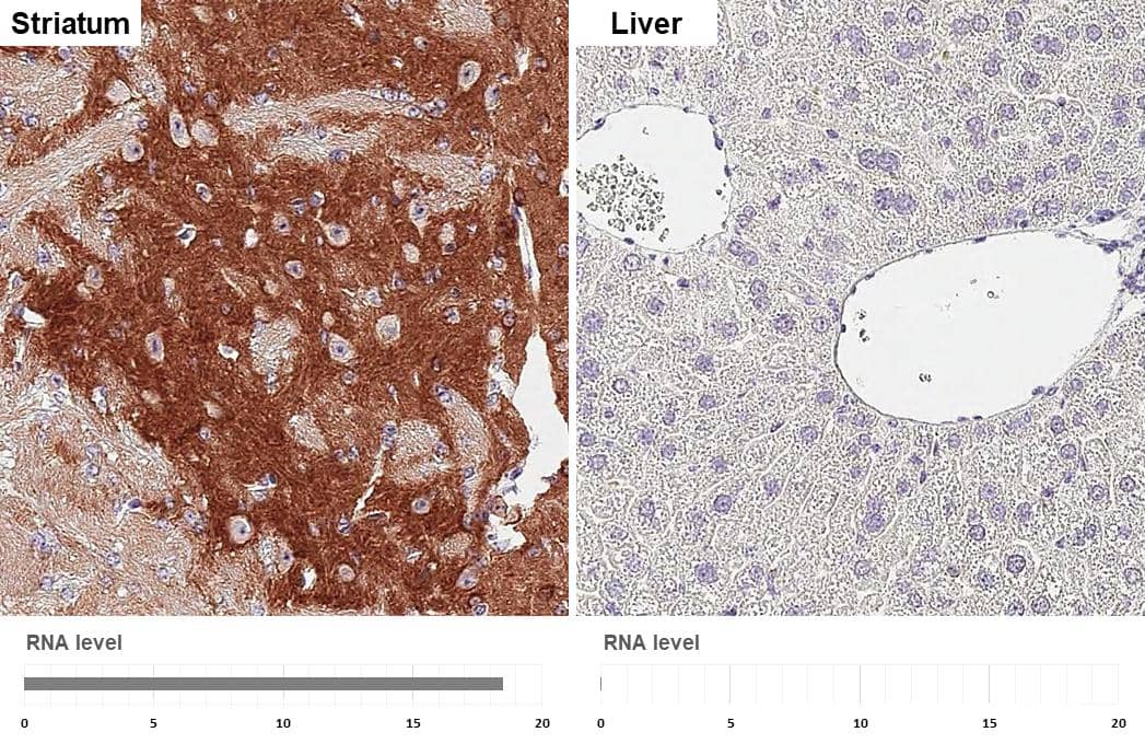 Immunohistochemistry-Paraffin PHACTR1 Antibody (HL3954)