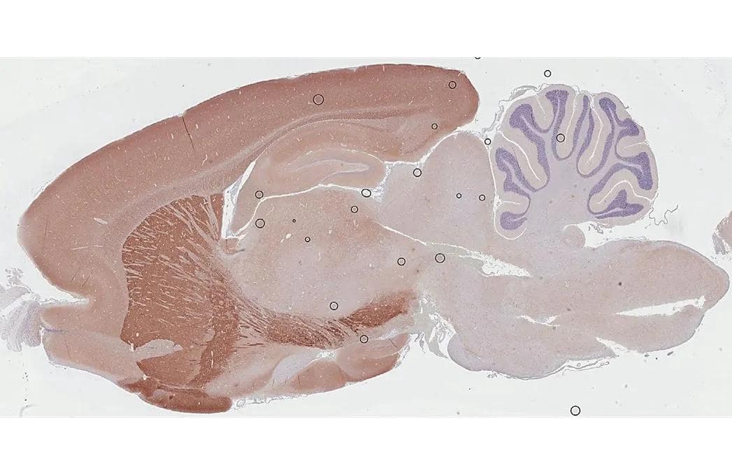Immunohistochemistry-Paraffin PHACTR1 Antibody (HL3954)