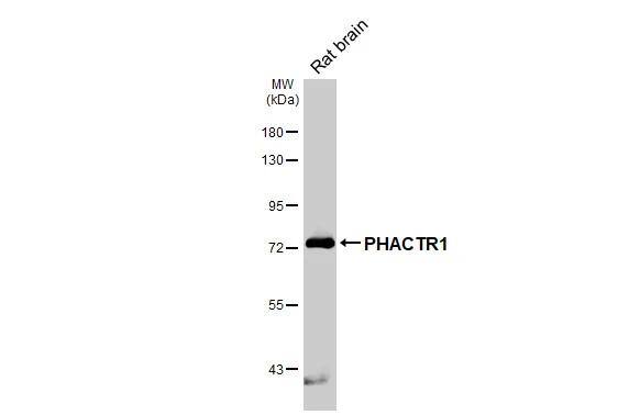 Rat tissue extract (50 ug) was separated by 7.5% SDS-PAGE, and the membrane was blotted with PHACTR1 antibody [HL3954] (NBP3-48857) diluted at 1:1000. The HRP-conjugated anti-rabbit IgG antibody was used to detect the primary antibody. 