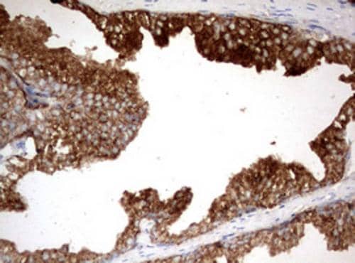 Immunohistochemistry:Kallikrein 2 Antibody (OTI5D6) - Azide and BSA Free[NBP3-48894]