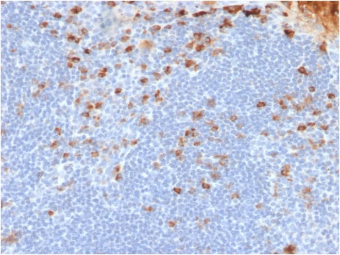 Formalin-fixed, paraffin-embedded human Tonsil stained with Kappa Light Chain Antibody (rL1C1).