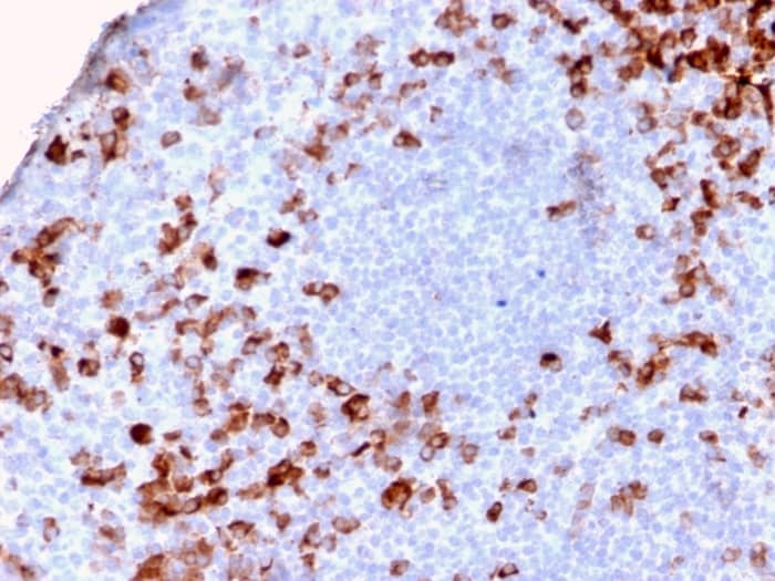 Formalin-fixed, paraffin-embedded human Tonsil stained with Kappa Light Chain Antibody (KLC2886R).