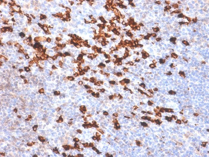 Formalin-fixed, paraffin-embedded human Tonsil stained with Kappa Light Chain Antibody (IGKC/1999R).