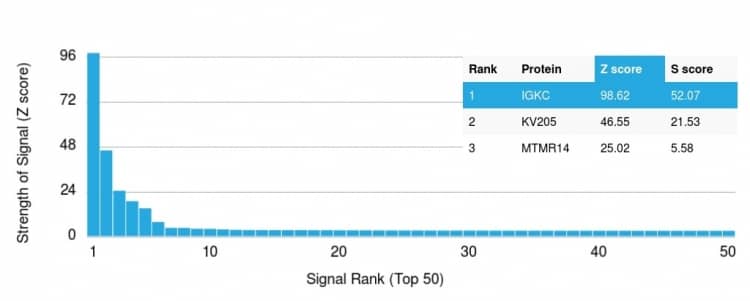 Analysis of Protein Array containing >19,000 full-length human proteins using Kappa Light Chain Antibody (IGKC/1999R).