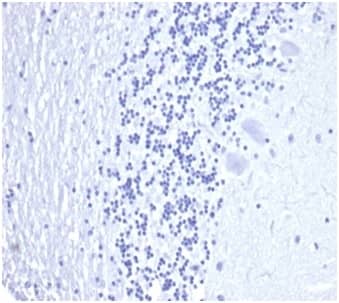 IHC analysis of formalin-fixed, paraffin-embedded human brain. Negative tissue control using Kallikrein 3/PSA Antibody (KLK3/4602R) at 2ug/ml in PBS for 30min RT. HIER: Tris/EDTA, pH9.0, 45min. 2�C: HRP-polymer, 30min. DAB, 5min.