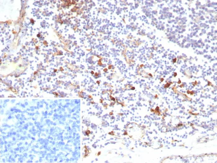 Formalin-fixed, paraffin-embedded human tonsil stained with IL-3R alpha/CD123 Antibody (rIL3RA/9212). Inset: PBS instead of primary antibody; secondary only negative control.