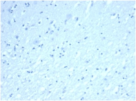 IHC analysis of formalin-fixed, paraffin-embedded human brain. Negative tissue control using Inhibin alpha Antibody (rINHA/6919)at 2ug/ml in PBS for 30min RT. HIER: Tris/EDTA, pH9.0, 45min. 2 °: HRP-polymer, 30min. DAB, 5min.