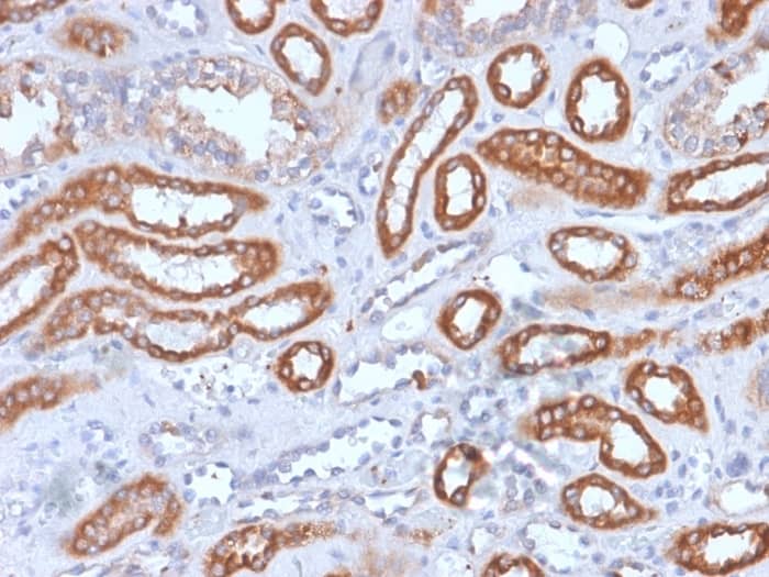 Formalin-fixed, paraffin-embedded human Spleen stained with Integrin beta 3/CD61 Antibody (rITGB3/1713).