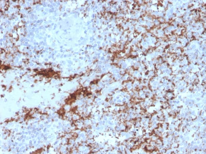 Formalin-fixed, paraffin-embedded human spleen stained with Integrin beta 3/CD61 Antibody (rITGB3/2145).