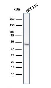 Western Blot analysis of HCT116 cell lysate using Cytokeratin 8 Antibody (rB22.1).