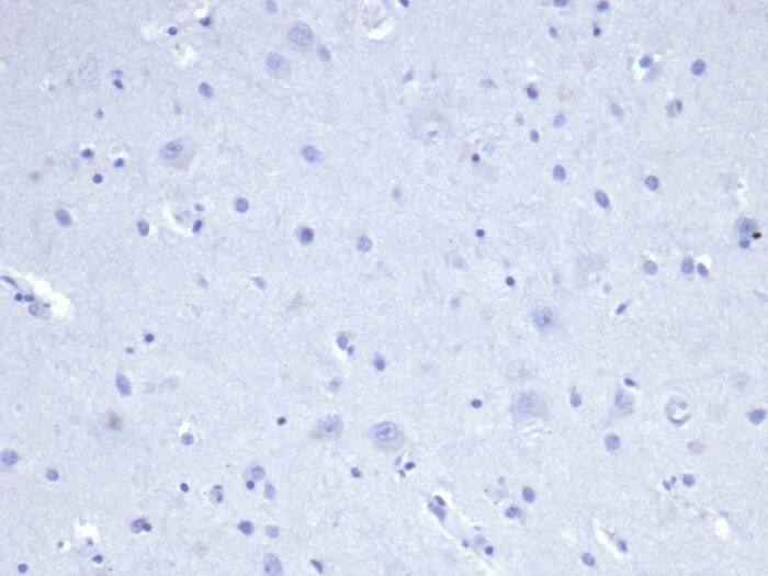 IHC analysis of formalin-fixed, paraffin-embedded human brain. Negative tissue control using Cytokeratin 8 Antibody (rKRT8/4209) at 2ug/ml in PBS for 30min RT. HIER: Tris/EDTA, pH9.0, 45min. 2�C: HRP-polymer, 30min. DAB, 5min.