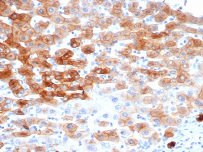 Formalin-fixed, paraffin-embedded human colon stained with Cytokeratin 8 Antibody (rKRT8/6471).