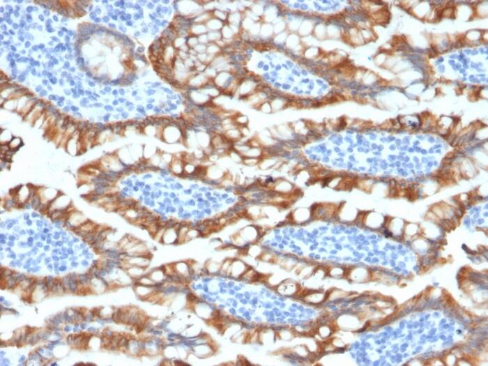 Formalin-fixed, paraffin-embedded human Small Intestine stained with Cytokeratin 8 Antibody (KRT8/2174R).