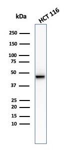 Western Blot analysis of HCT116 cell lysate using Cytokeratin 8 Antibody (KRT8/2174R).
