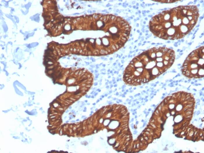 Formalin-fixed, paraffin-embedded human colon stained with Cytokeratin 8 Antibody (KRT8/4067R).