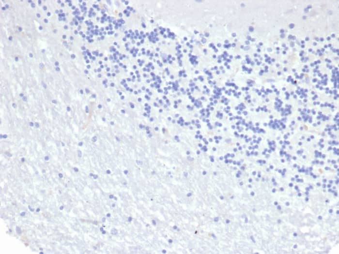 IHC analysis of formalin-fixed, paraffin-embedded human brain. Negative tissue control using Cytokeratin 8 Antibody (KRT8/6472R) at 2ug/ml in PBS for 30min RT. HIER: Tris/EDTA, pH9.0, 45min. 2�C: HRP-polymer, 30min. DAB, 5min.