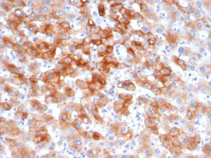 Formalin-fixed, paraffin-embedded human colon stained with Cytokeratin 8 Antibody (KRT8/6472R).