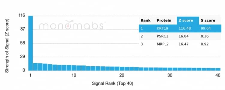 Analysis of Protein Array containing more than 19,000 full-length human proteins using Cytokeratin 19 Antibody (rKRT19/799).