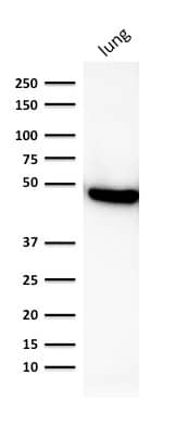 Western Blot Analysis of human lung lysate using Cytokeratin 19 Antibody (rKRT19/800).