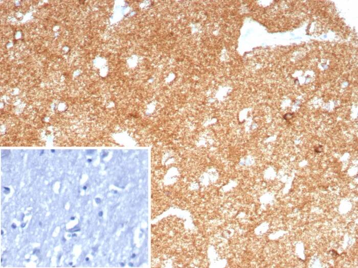Formalin-fixed, paraffin-embedded human brain stained with LRP-1 Antibody (LRP1/8771R). Inset: PBS instead of primary antibody; secondary only negative control.