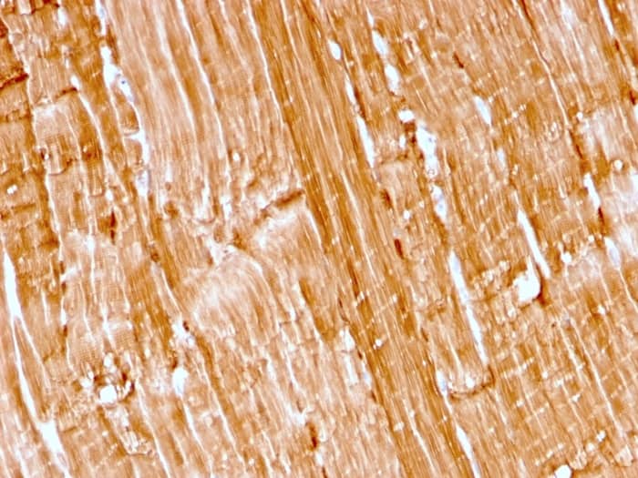Formalin-fixed, paraffin-embedded human skeletal muscle stained with Myoglobin Antibody (rMB/2105).