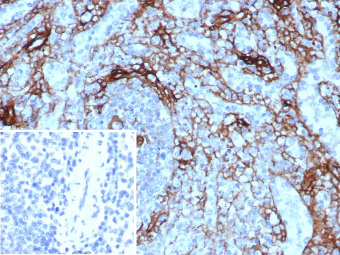 Formalin-fixed, paraffin-embedded human spleen stained with NGFR/TNFRSF16/p75NTR Antibody (NGFR/8590R). Inset: PBS instead of primary antibody; secondary only negative control.