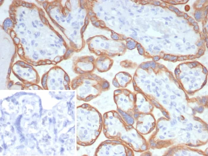 Formalin-fixed, paraffin-embedded human placenta stained with L1TD1 Antibody (L1TD1/7941). Inset: PBS instead of primary antibody; secondary only negative control.