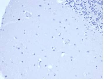 IHC analysis of formalin-fixed, paraffin-embedded human brain. Negative tissue control using Prolactin Antibody (rPRL/4907) at 2ug/ml in PBS for 30min RT. HIER: Tris/EDTA, pH9.0, 45min. 2�C: HRP-polymer, 30min. DAB, 5min.