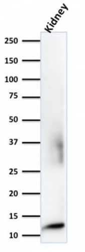 Western Blot Analysis of human kidney tissue lysates using beta 2-Microglobulin Antibody (rB2M/961).