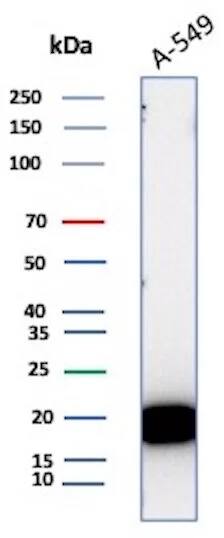 Western Blot Analysis of A-549 cell lysate using Bax Antibody (BAX/3158R).