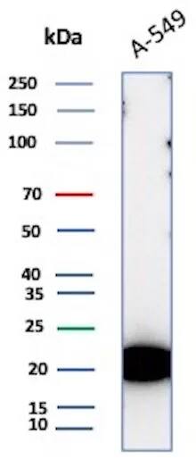 Western Blot Analysis of A-549 cell lysate using Bax Antibody (BAX/9925R).