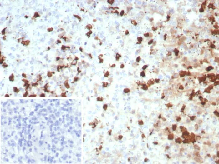 Formalin-fixed, paraffin-embedded human spleen stained with EN-RAGE/S100A12 Antibody (S100A12/8952R). Inset: PBS instead of primary antibody; secondary only negative control.