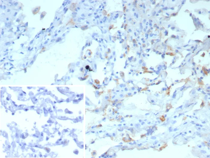 Formalin-fixed, paraffin-embedded human lung stained with SP-D Antibody (rSFTPD/8065). Inset: PBS instead of primary antibody; secondary only negative control.