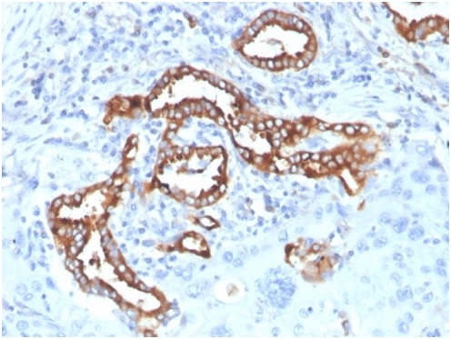 Formalin-fixed, paraffin-embedded human lung stained with SP-D Antibody (SFTPD/7084R).