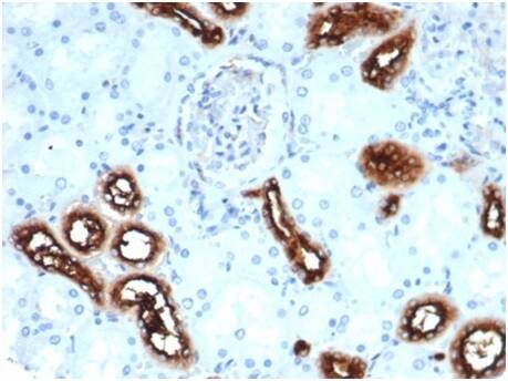 IHC analysis of formalin-fixed, paraffin-embedded human kidney. Cytoplasmic staining using Fascin Antibody (rFSCN1/6464) at 2ug/ml in PBS for 30min RT. HIER: Tris/EDTA, pH9.0, 45min. 2�C: HRP-polymer, 30min. DAB, 5min.