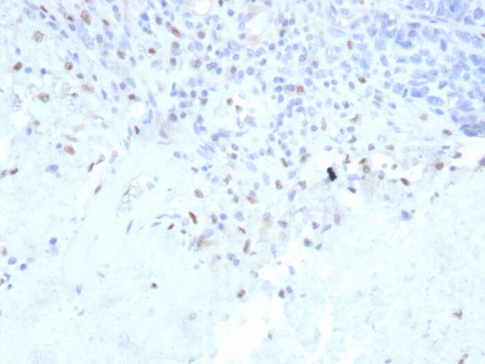 Formalin-fixed, paraffin-embedded human lymph node stained with PU.1/Spi-1 Antibody (rPU1/2146).