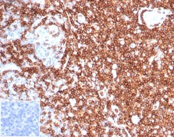 Formalin-fixed, paraffin-embedded human tonsil stained with CD43/Sialophorin Antibody (rSPN/6563) at 2ug/ml. Inset: PBS instead of primary antibody, secondary negative control.