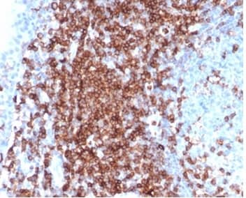 IHC analysis of formalin-fixed, paraffin-embedded human tonsil. Strong membranous staining using CD43/Sialophorin Antibody (SPN/6562R) at 2ug/ml in PBS for 30min RT. HIER: Tris/EDTA, pH9.0, 45min. 2�C: HRP-polymer, 30min. DAB, 5min.