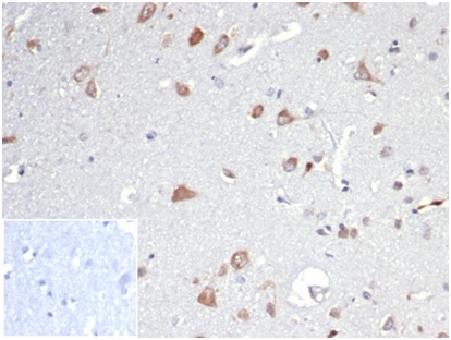 Formalin-fixed, paraffin-embedded human brain stained with Osteopontin/OPN Antibody (OSP/4589). Inset: PBS instead of primary antibody; secondary only negative control.