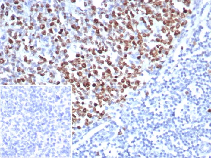 Formalin-fixed, paraffin-embedded human tonsil stained with TOP2A Antibody (rTOP2A/8339). Inset: PBS instead of primary antibody; secondary only negative control.
